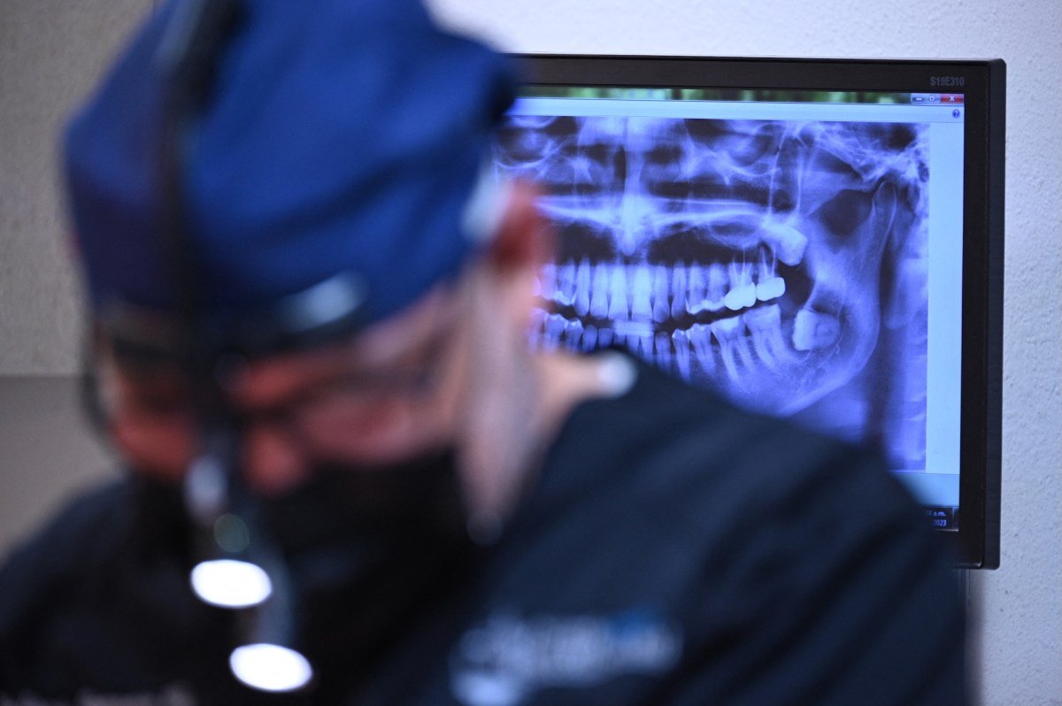 A dentist works on a patient at the Rubio Dental Group offices in Los Algodones, Mexico, just across the border from California and Arizona, on April 11, 2023