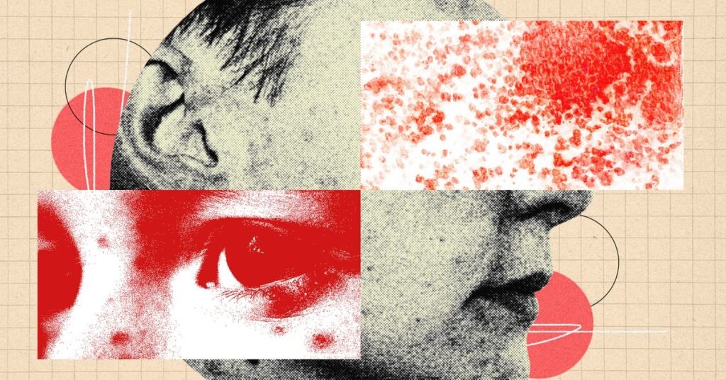 Você precisa ficar mais assustado com as telhas